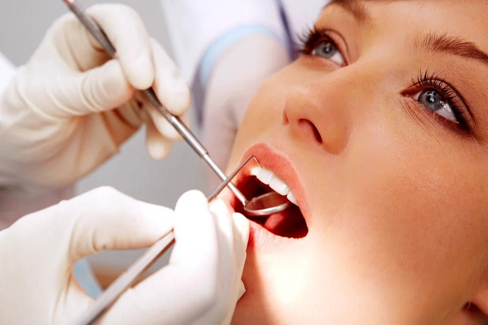 Lente de Contato Dental: O que é? Como funciona? 5 dentes brancos
